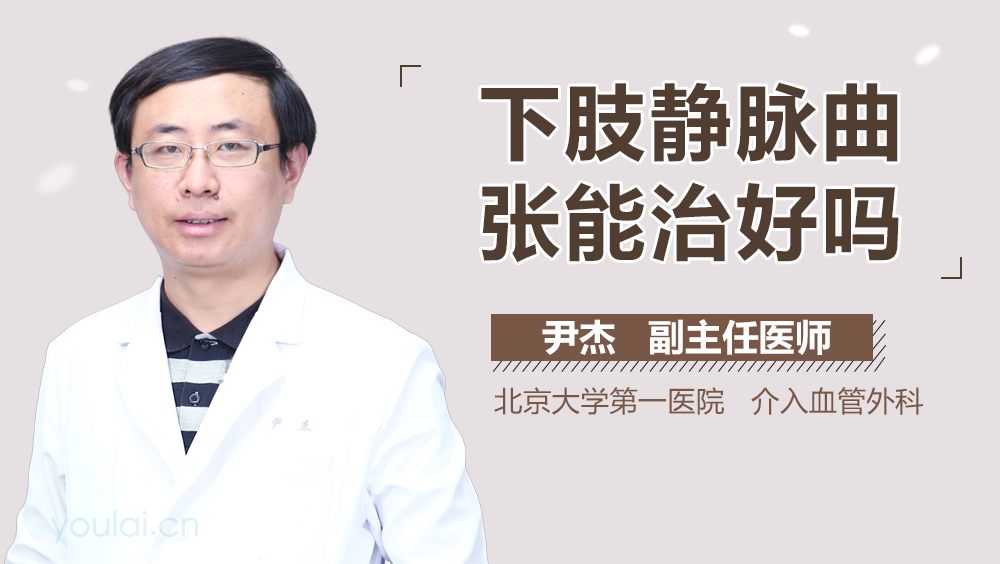 下肢静脉曲张能治好吗