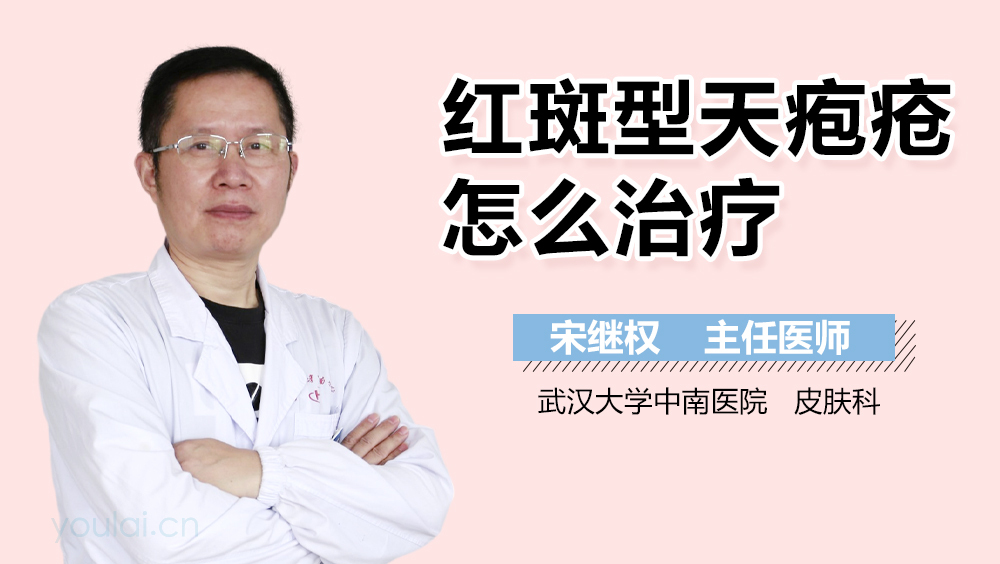 红斑型天疱疮怎么治疗