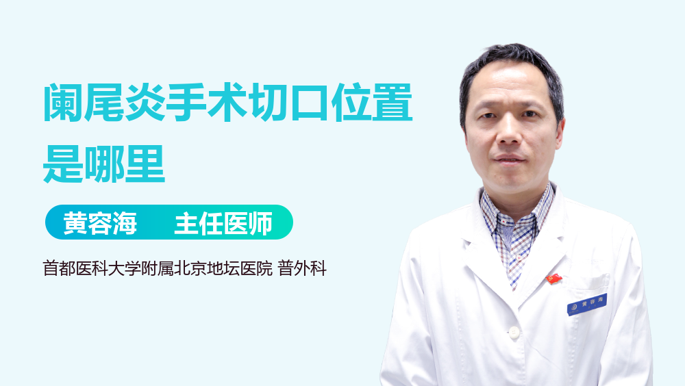 阑尾炎手术切口位置是哪里