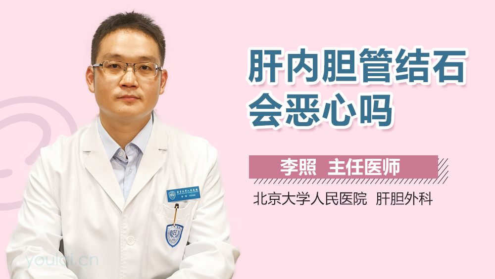 肝内胆管结石会恶心吗