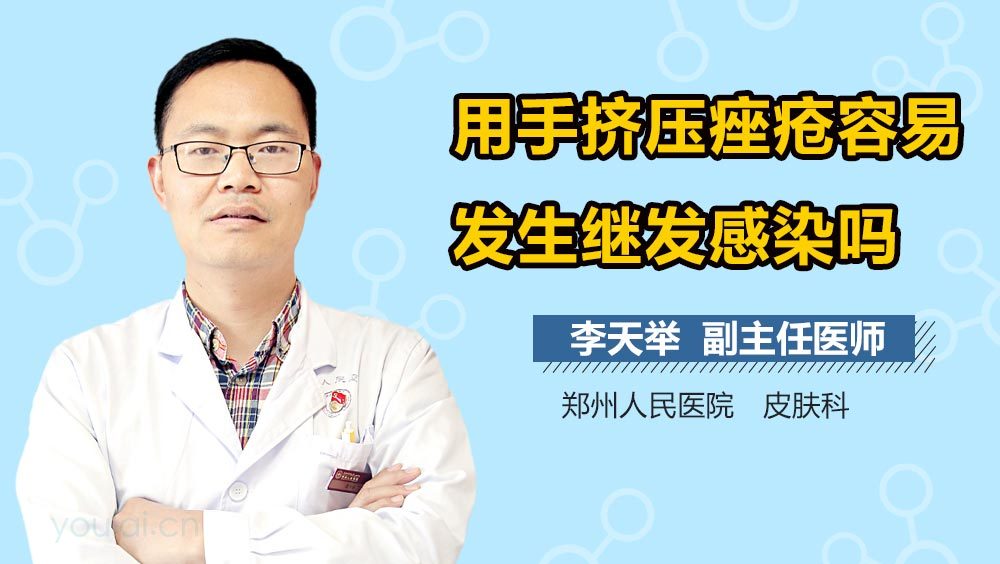 用手挤压痤疮容易发生继发感染吗