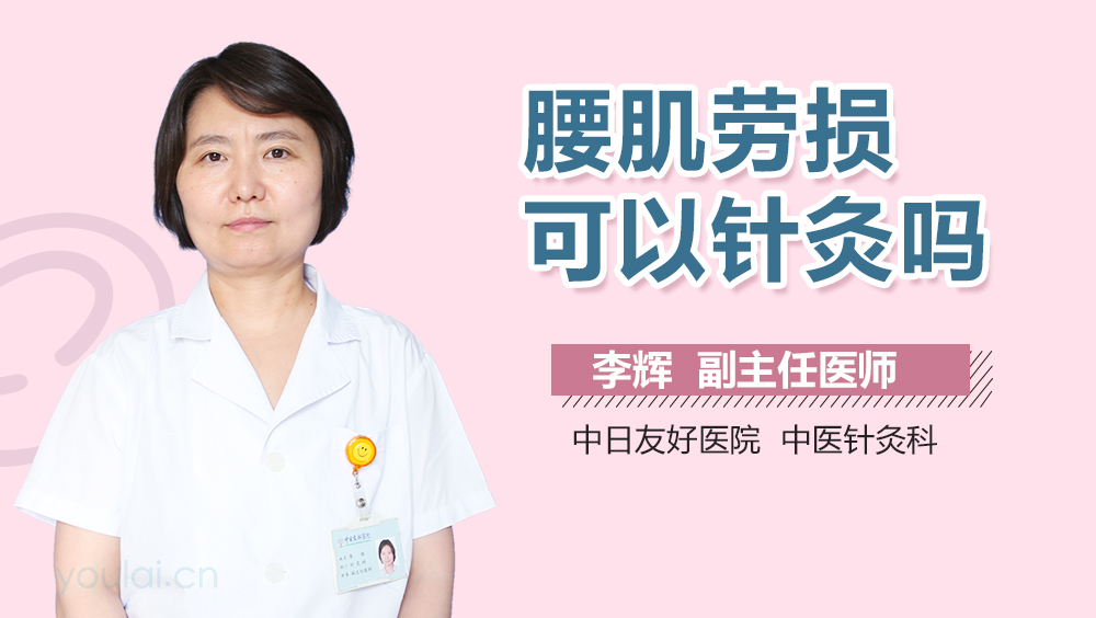 腰肌劳损可以针灸吗