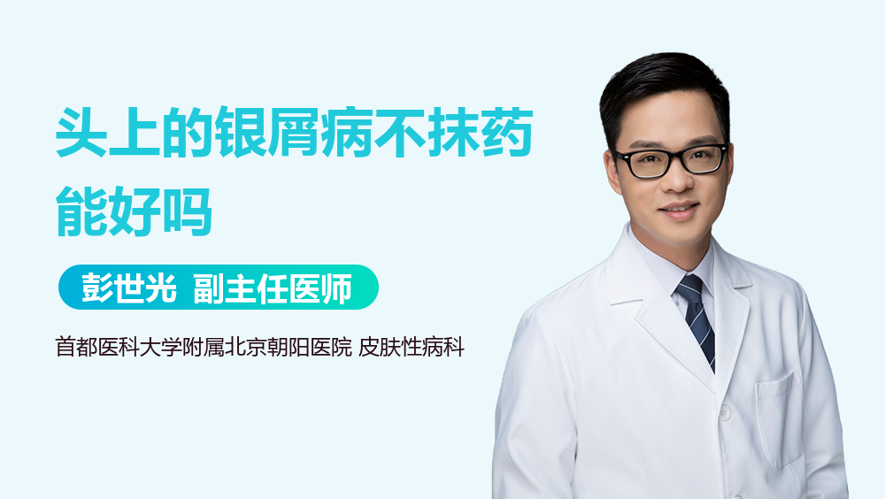 头上的银屑病不抹药能好吗