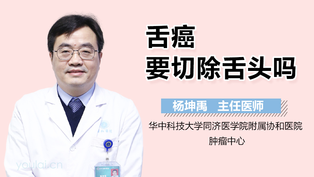 舌癌要切除舌头吗