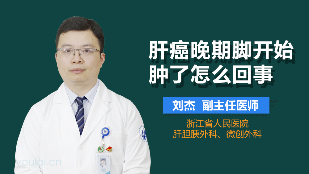 肝癌晚期脚开始肿了怎么回事