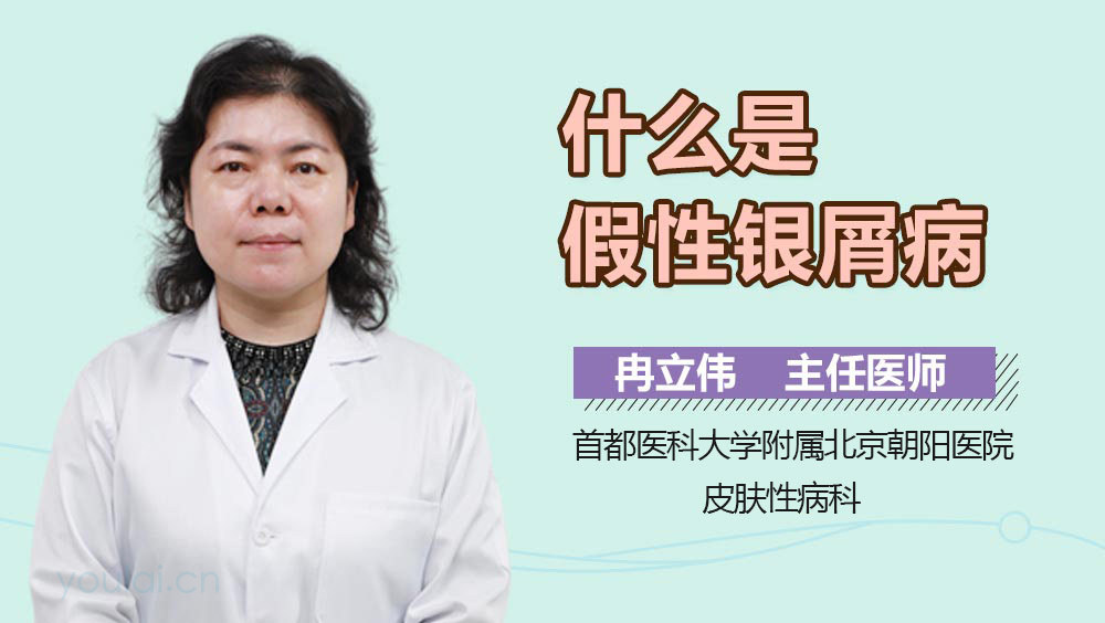 什么是假性银屑病