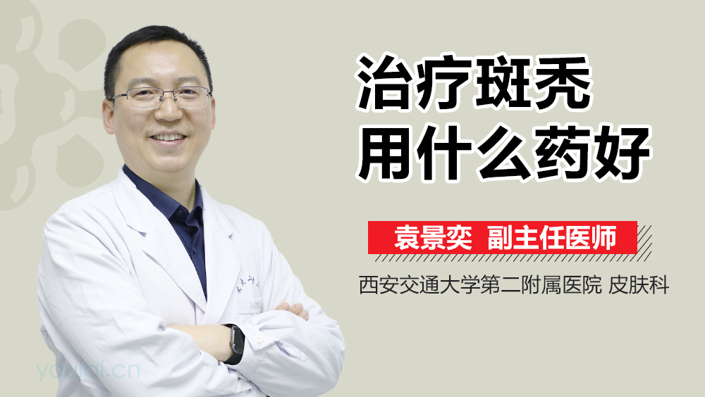 治疗斑秃用什么药好