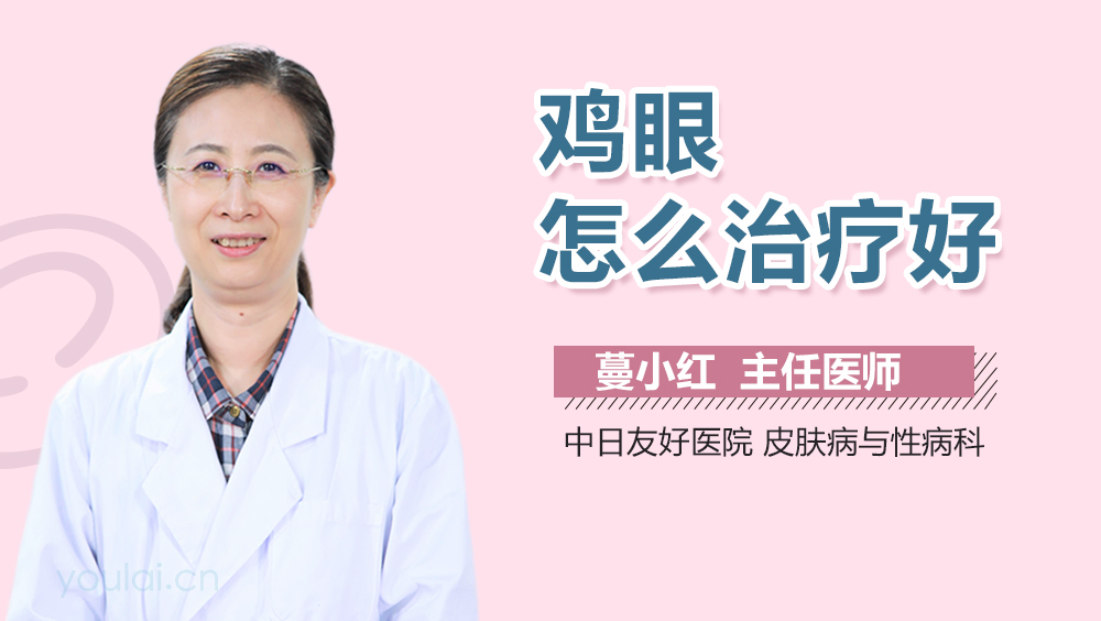 鸡眼怎么治疗好