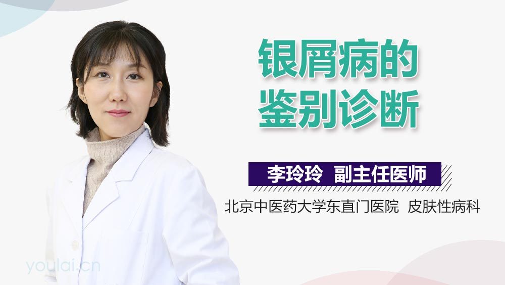银屑病的鉴别诊断