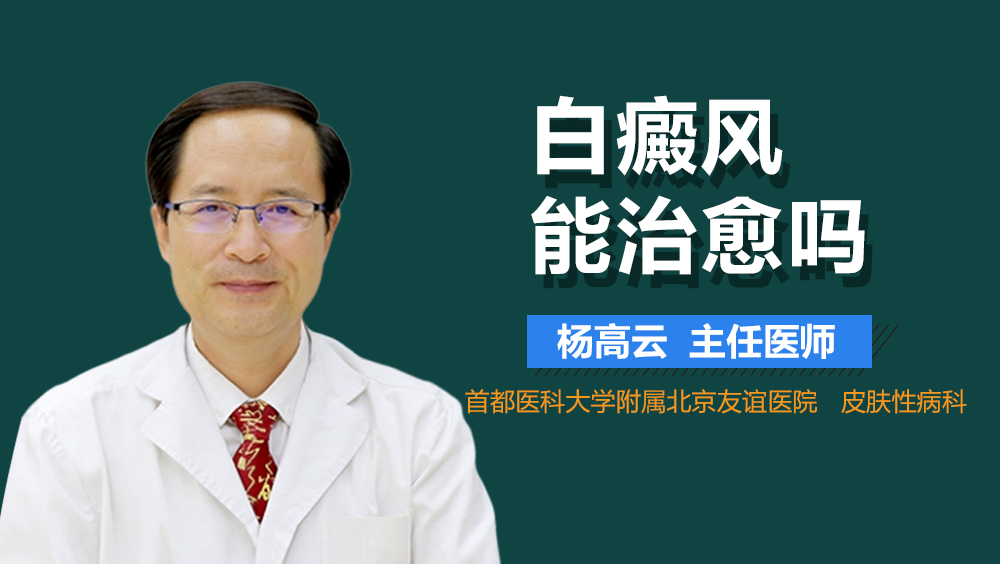 白癜风能治愈吗