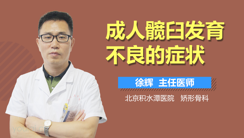 成人髋臼发育不良的症状