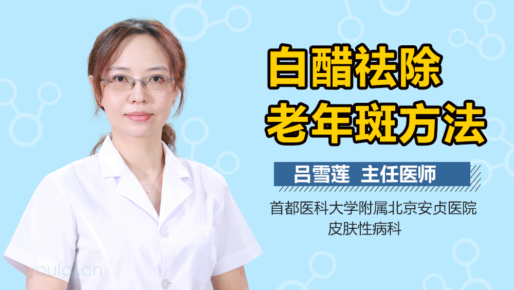 白醋祛除老年斑方法