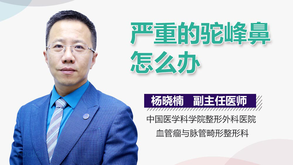 严重的驼峰鼻怎么办