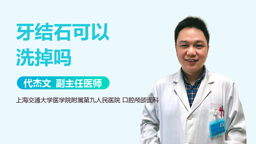 牙结石可以洗掉吗