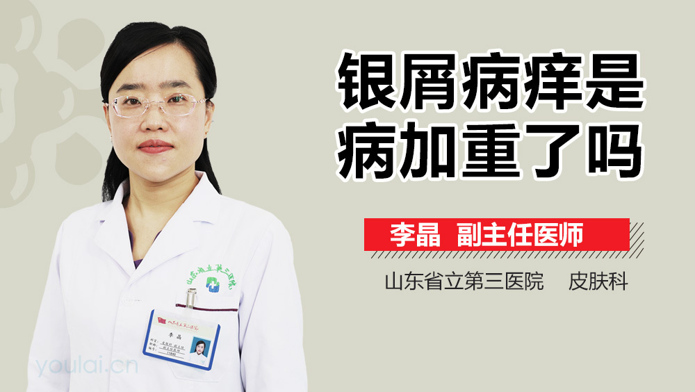 银屑病痒是病加重了吗