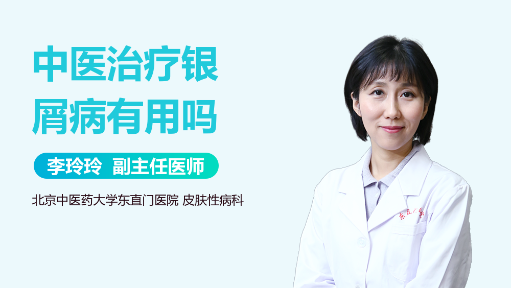 中医治疗银屑病有用吗