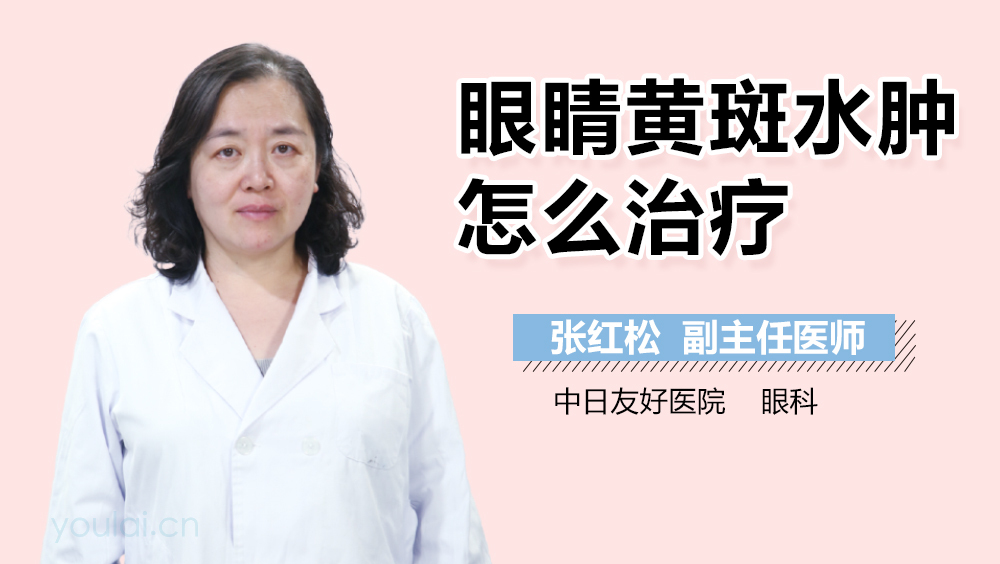 眼睛黄斑水肿怎么治疗