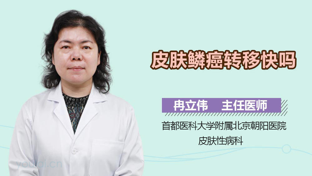 皮肤鳞癌转移快吗