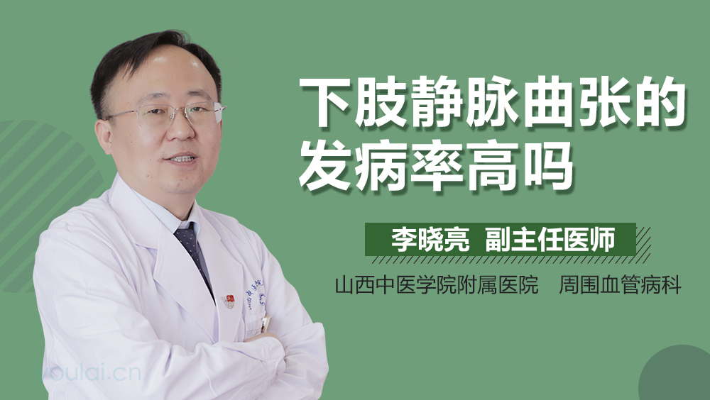 下肢静脉曲张的发病率高吗