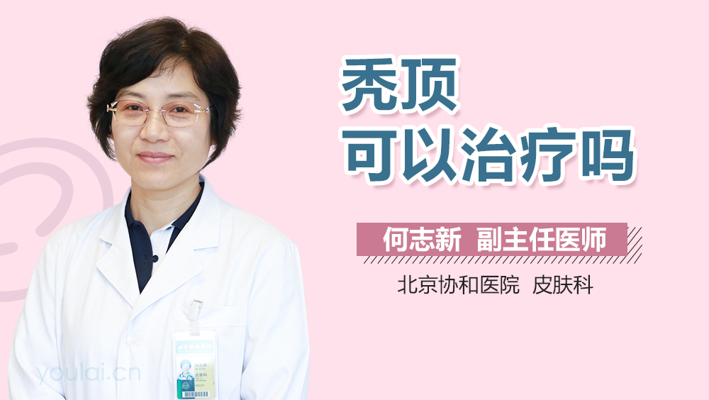 秃顶可以治疗吗