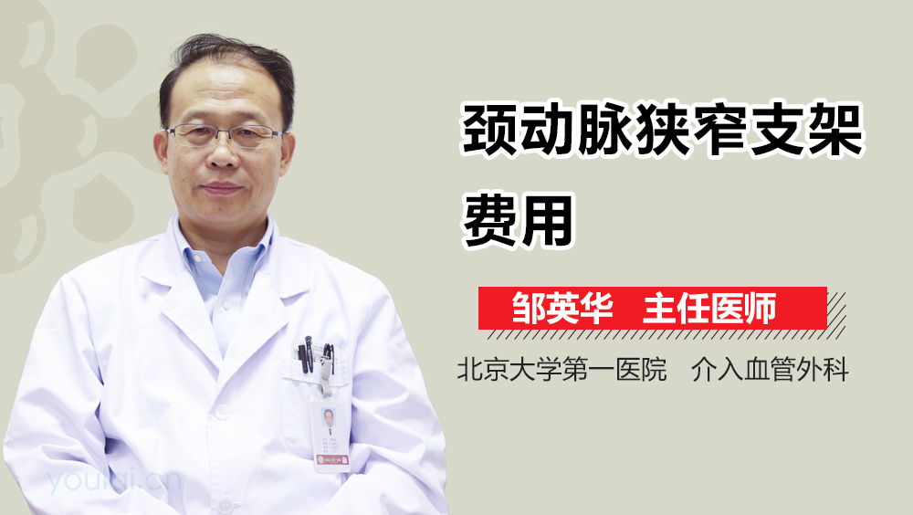 颈动脉狭窄支架费用