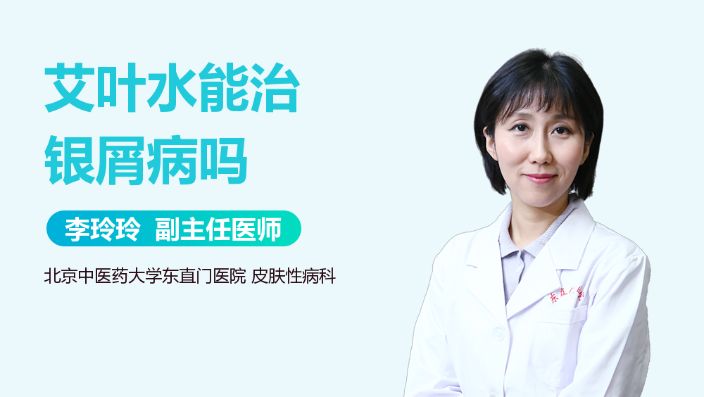 艾叶水能治银屑病吗