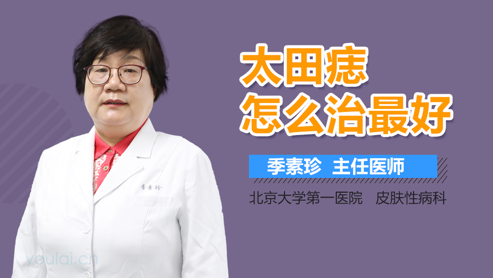 太田痣怎么治最好
