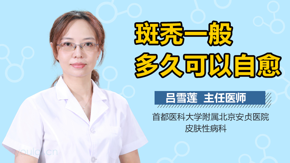 斑秃一般多久可以自愈