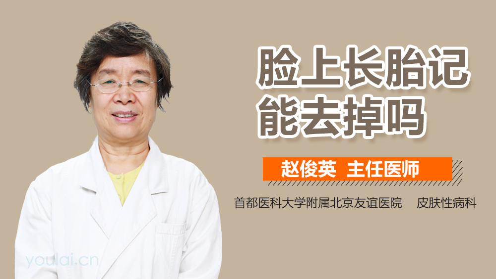 脸上长胎记能去掉吗