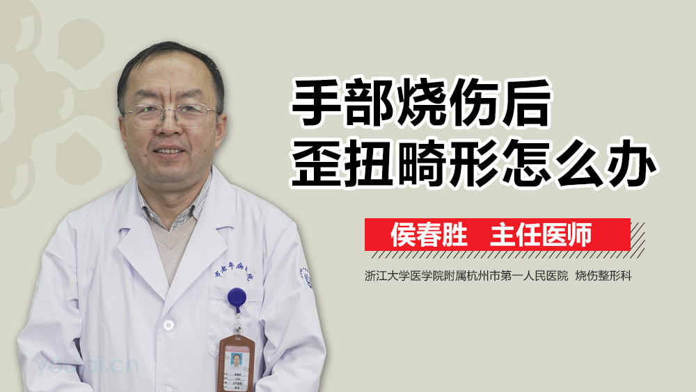 手部烧伤后歪扭畸形怎么办