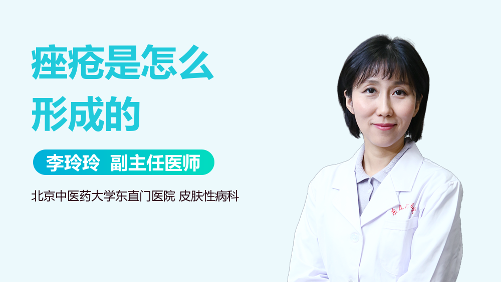 痤疮是怎么形成的