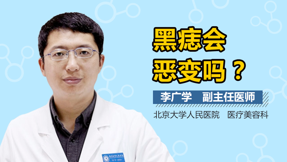 黑痣会恶变吗