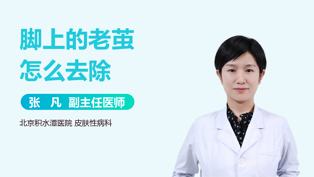 脚上的老茧怎么去除