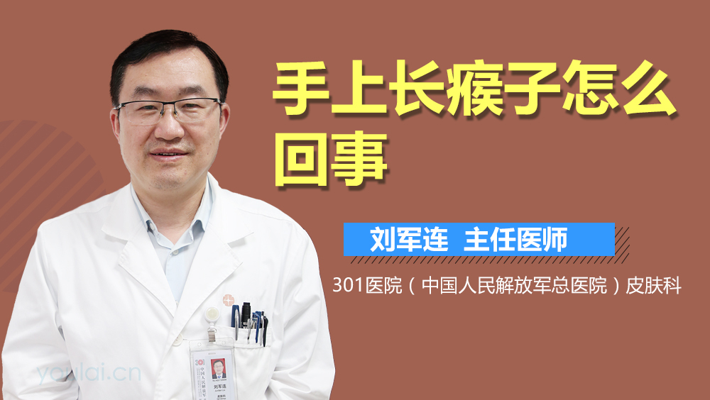 手上长瘊子怎么回事