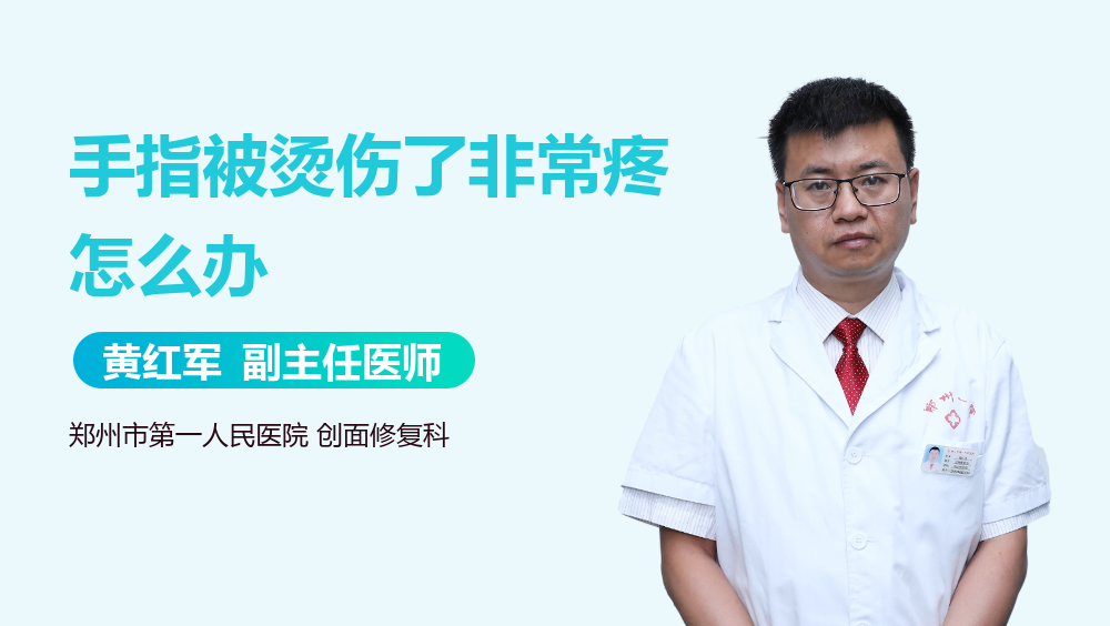 手指被烫伤了非常疼怎么办