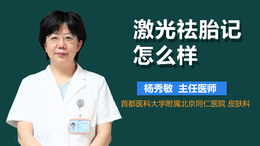 激光祛胎记怎么样