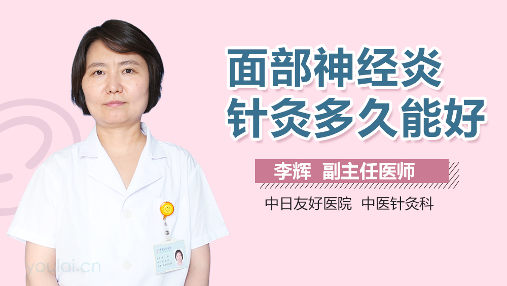 面部神经炎针灸多久能好
