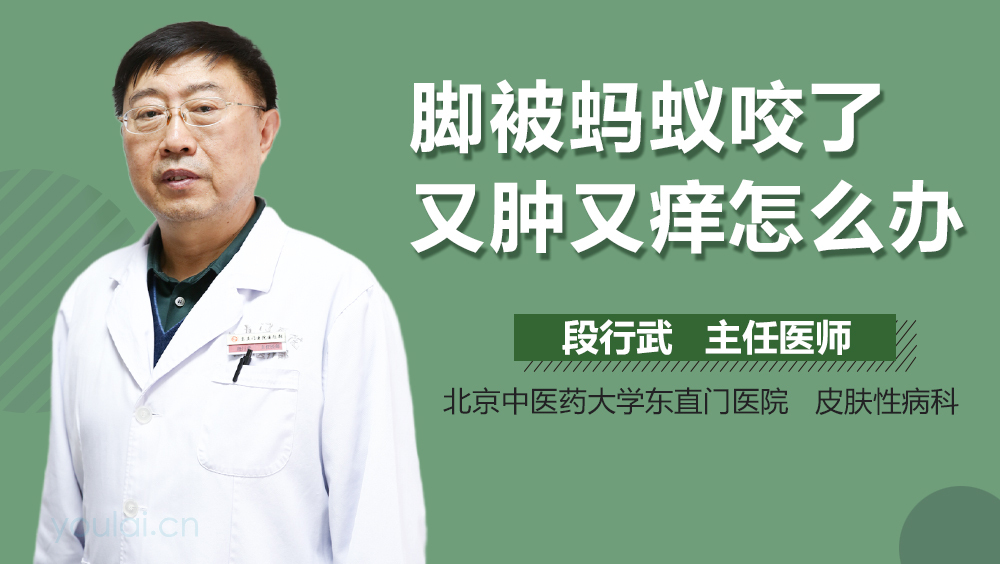 脚被蚂蚁咬了又肿又痒怎么办