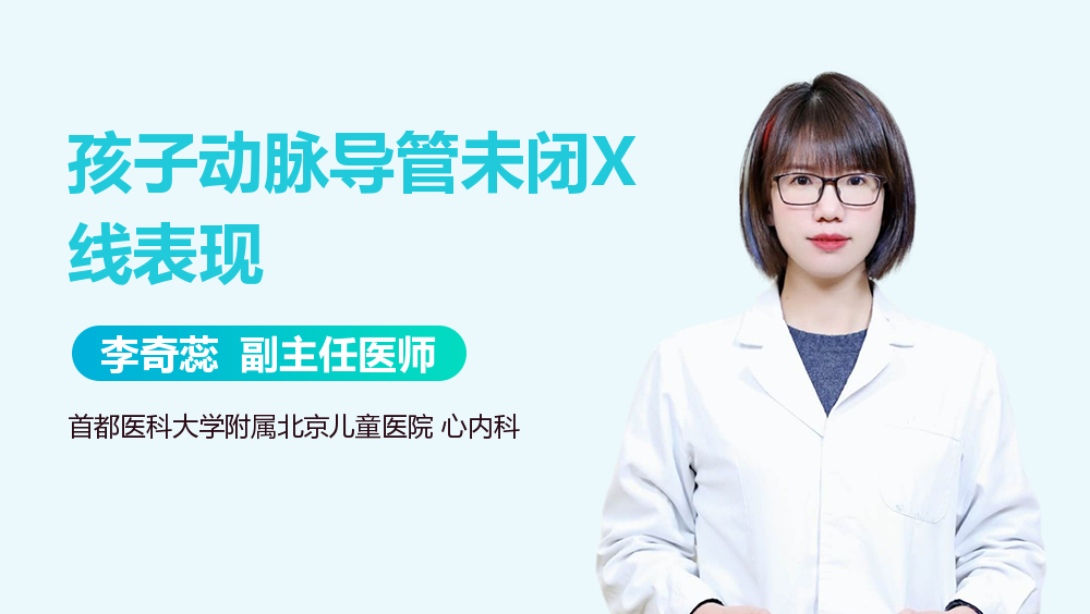 孩子动脉导管未闭X线表现