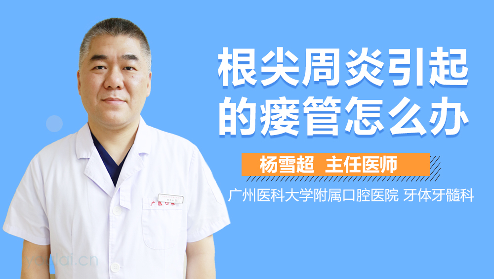 根尖周炎引起的瘘管怎么办