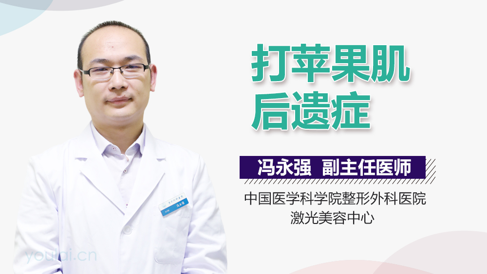 打苹果肌后遗症