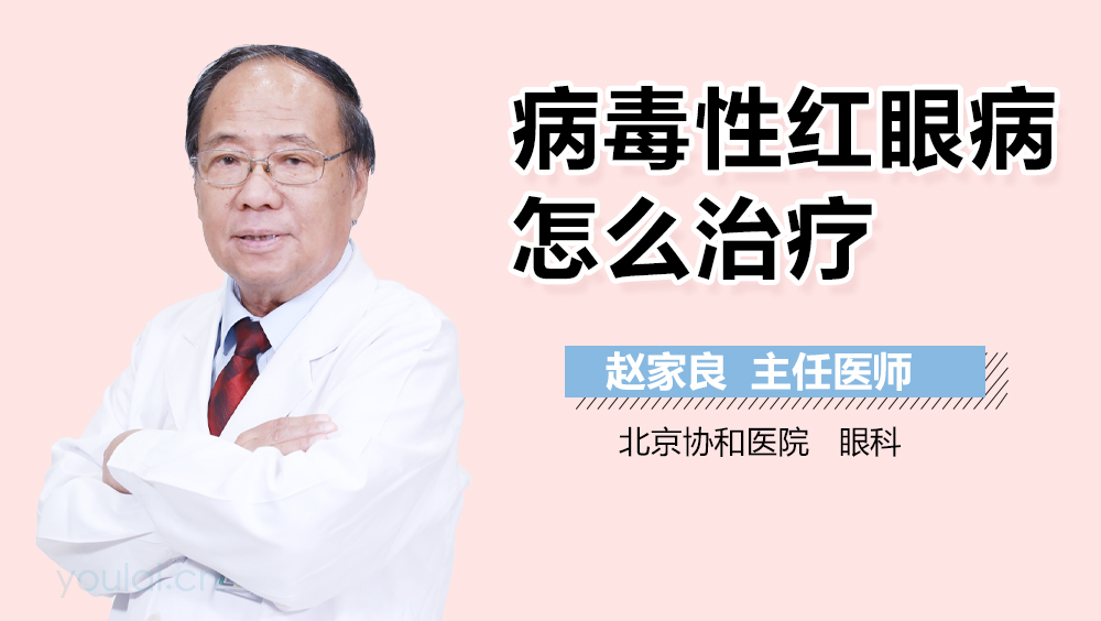 病毒性红眼病怎么治疗