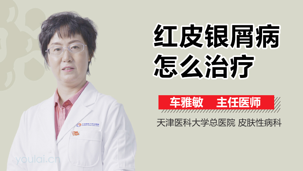 红皮银屑病怎么治疗