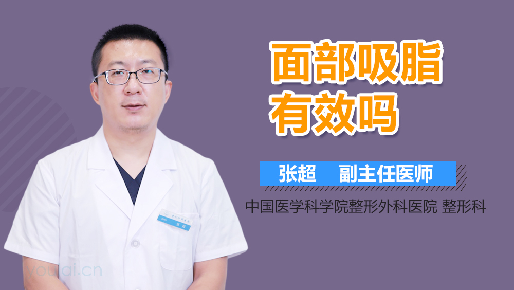 面部吸脂有效吗