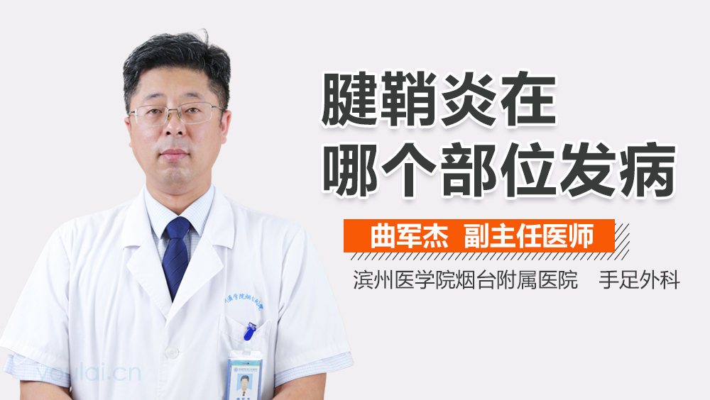 腱鞘炎在哪个部位发病