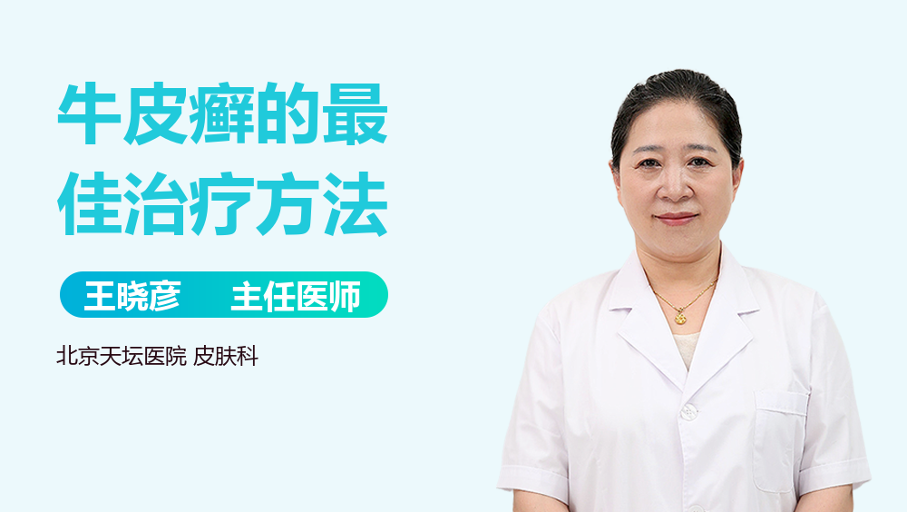 牛皮癣的最佳治疗方法