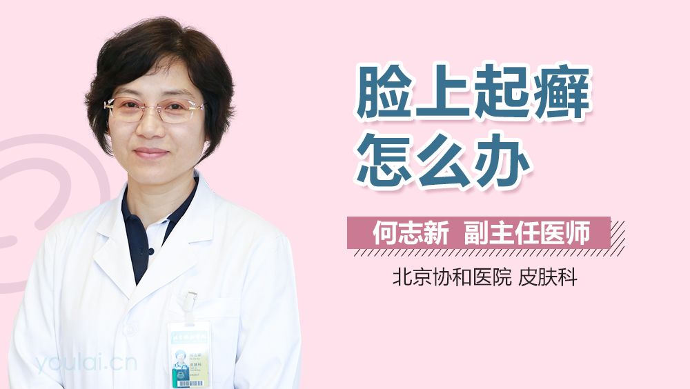 脸上起癣怎么办