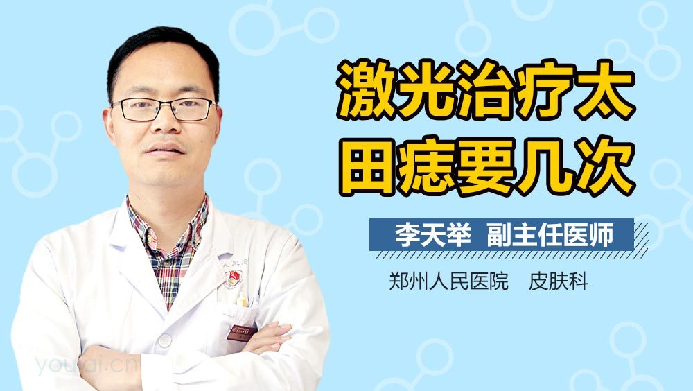 激光治疗太田痣要几次