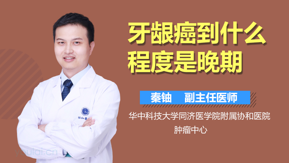 牙龈癌到什么程度是晚期