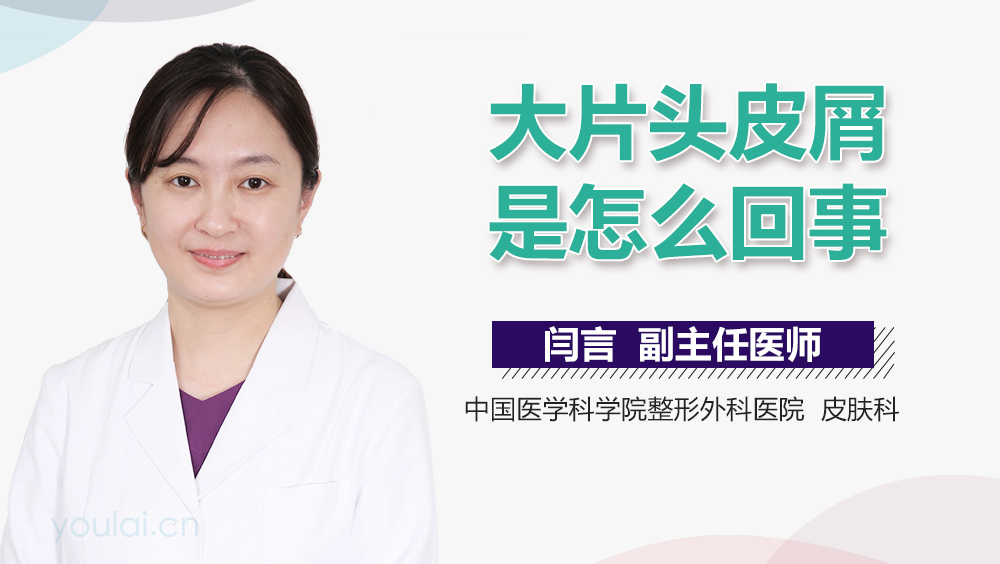 大片头皮屑是怎么回事